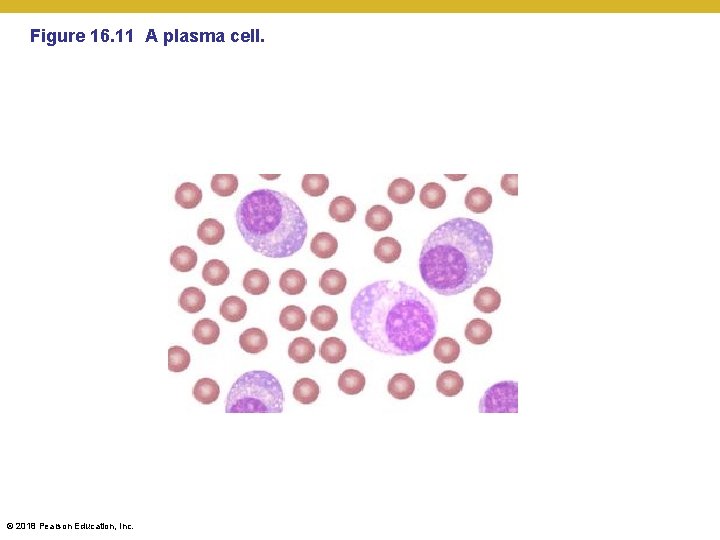 Figure 16. 11 A plasma cell. © 2018 Pearson Education, Inc. 