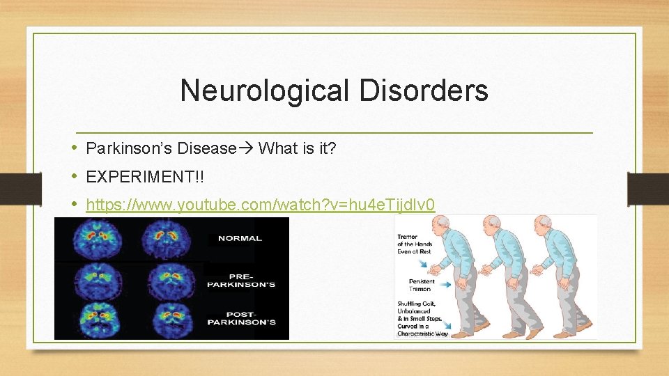 Neurological Disorders • Parkinson’s Disease What is it? • EXPERIMENT!! • https: //www. youtube.