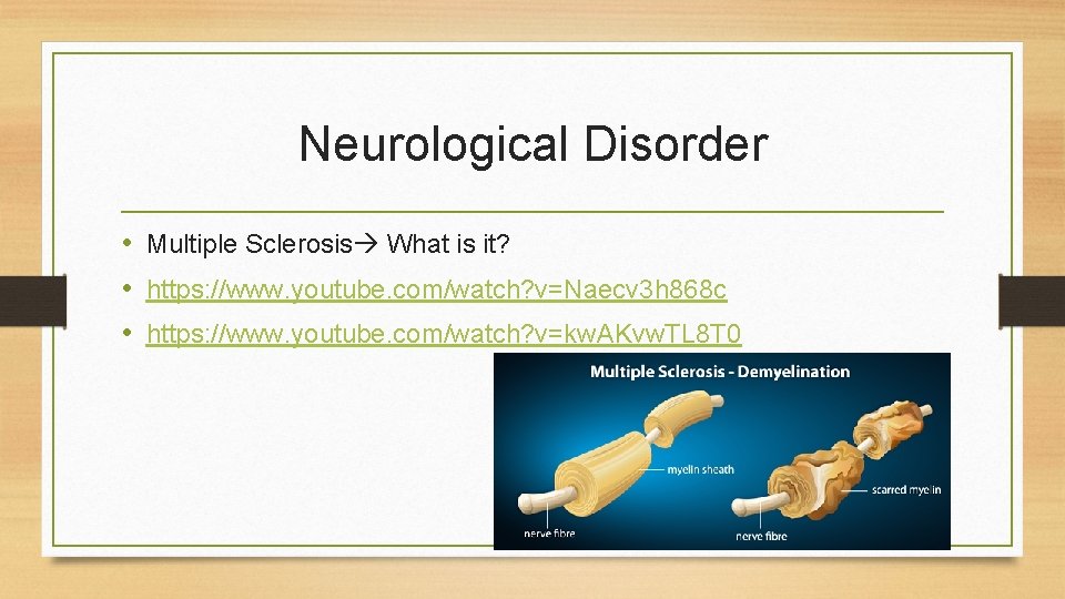Neurological Disorder • Multiple Sclerosis What is it? • https: //www. youtube. com/watch? v=Naecv