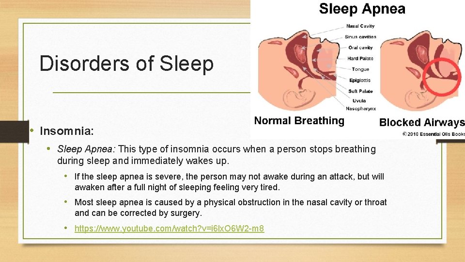 Disorders of Sleep • Insomnia: • Sleep Apnea: This type of insomnia occurs when