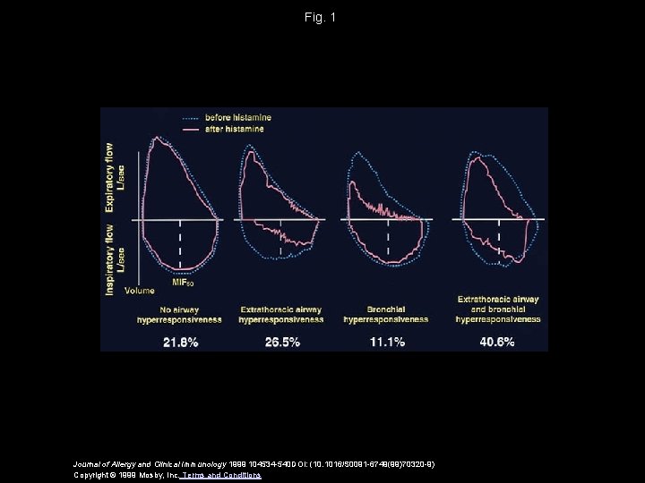 Fig. 1 Journal of Allergy and Clinical Immunology 1999 104534 -540 DOI: (10. 1016/S