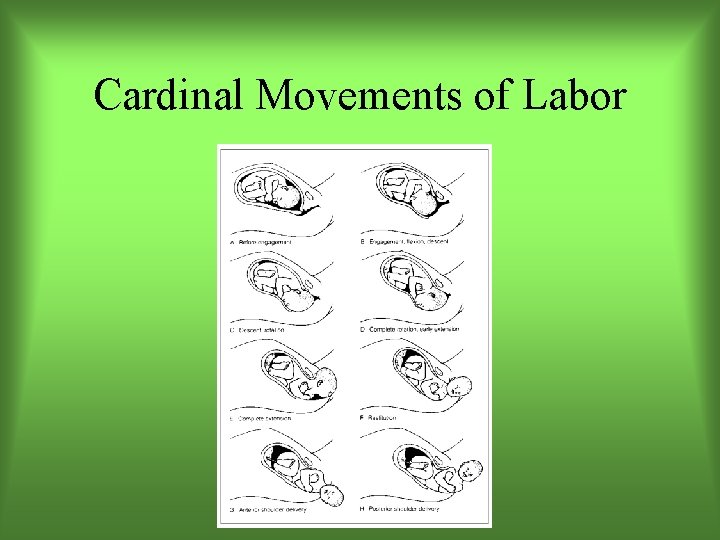 Cardinal Movements of Labor 