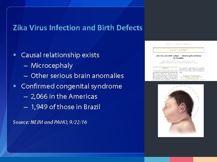 Zika Virus Infection and Birth Defects § Causal relationship exists – Microcephaly – Other