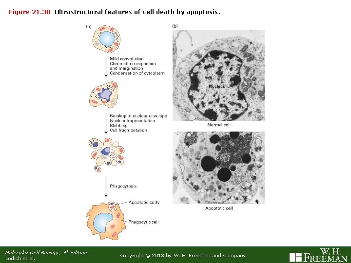 Figure 21. 30 Ultrastructural features of cell death by apoptosis. Molecular Cell Biology, 7