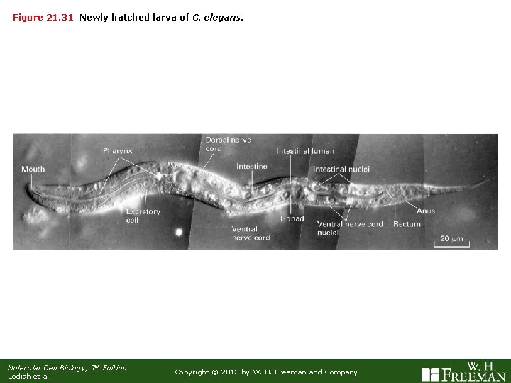 Figure 21. 31 Newly hatched larva of C. elegans. Molecular Cell Biology, 7 th