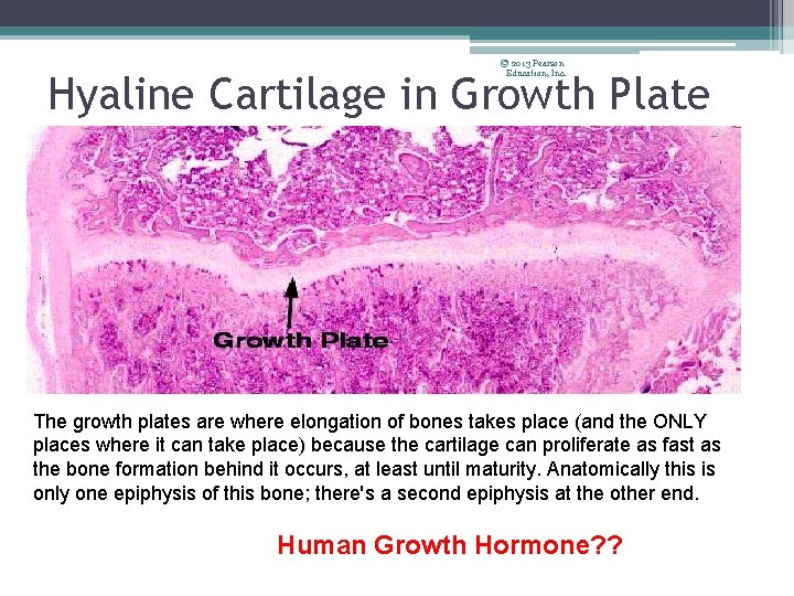 © 2013 Pearson Education, Inc. Hyaline Cartilage in Growth Plate The growth plates are
