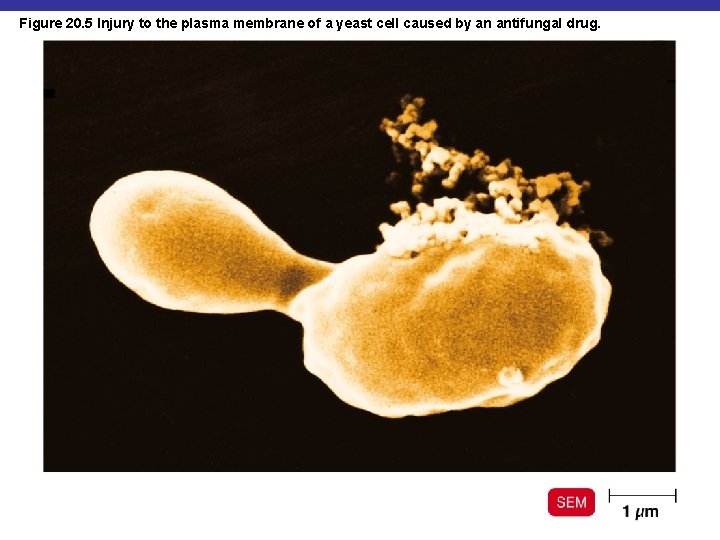 Figure 20. 5 Injury to the plasma membrane of a yeast cell caused by