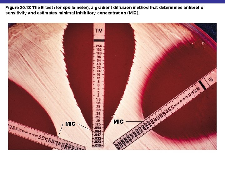 Figure 20. 18 The E test (for epsilometer), a gradient diffusion method that determines