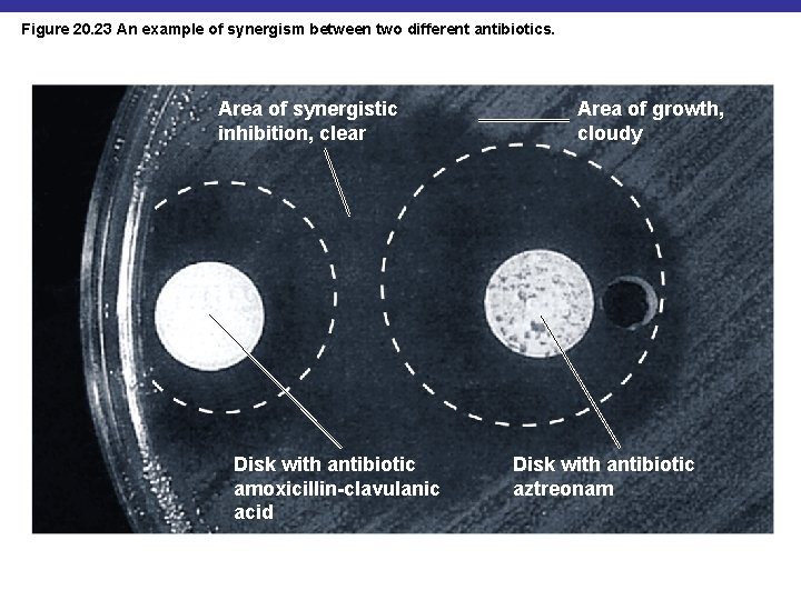 Figure 20. 23 An example of synergism between two different antibiotics. Area of synergistic