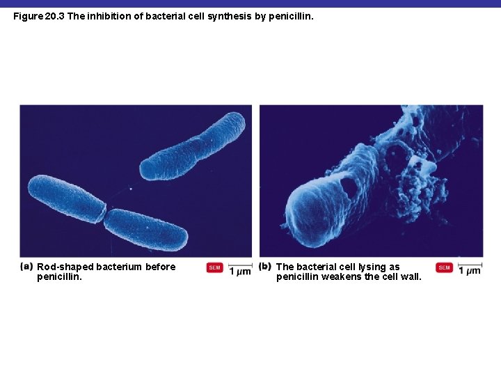 Figure 20. 3 The inhibition of bacterial cell synthesis by penicillin. Rod-shaped bacterium before