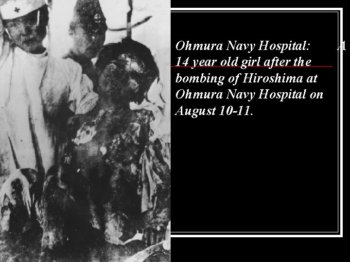 Ohmura Navy Hospital: 14 year old girl after the bombing of Hiroshima at Ohmura