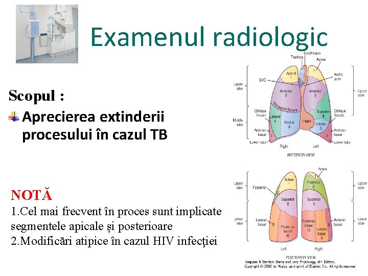 Examenul radiologic Scopul : Aprecierea extinderii procesului în cazul TB NOTĂ 1. Cel mai