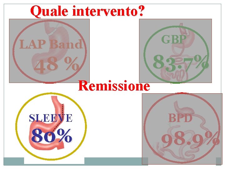 Quale intervento? LAP Band 48 % GBP 83. 7% Remissione SLEEVE 80% BPD 98.