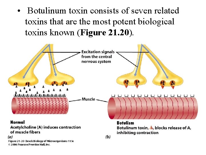  • Botulinum toxin consists of seven related toxins that are the most potent