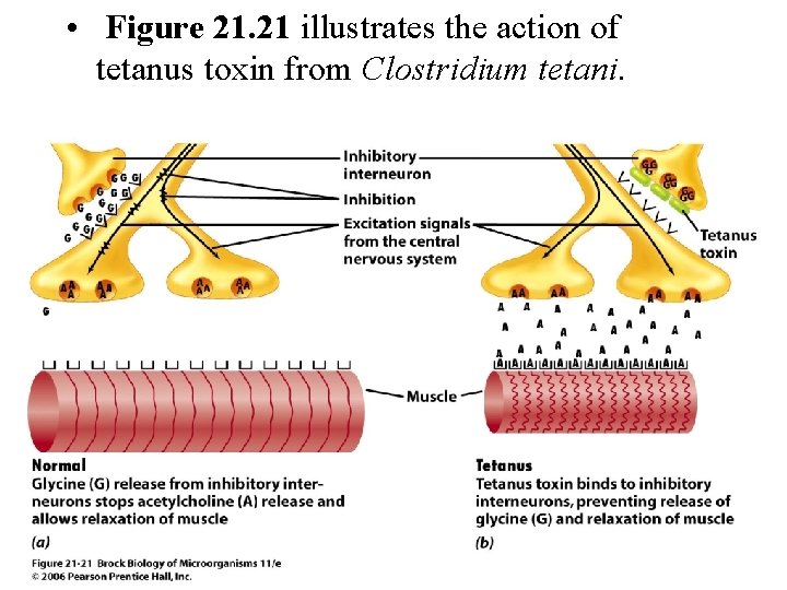  • Figure 21. 21 illustrates the action of tetanus toxin from Clostridium tetani.