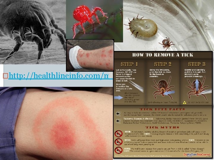 �http: //healthlineinfo. com/mite-allergy. html 