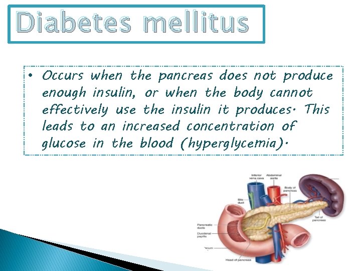 Diabetes mellitus • Occurs when the pancreas does not produce enough insulin, or when