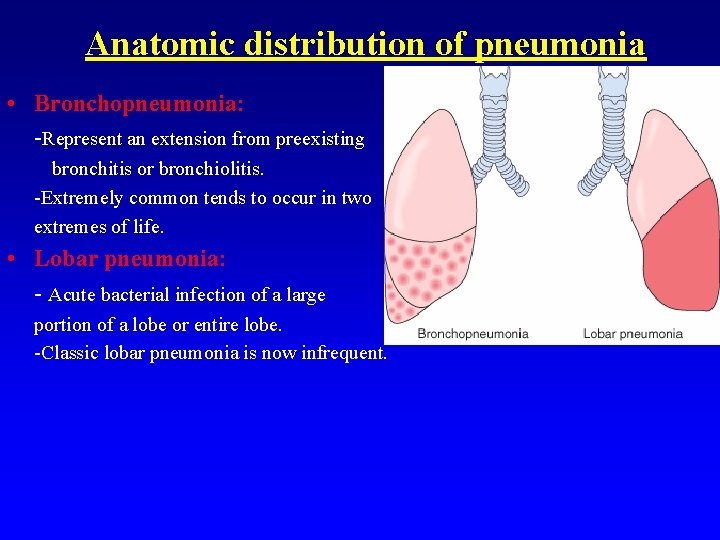 Anatomic distribution of pneumonia • Bronchopneumonia: -Represent an extension from preexisting bronchitis or bronchiolitis.