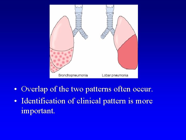  • Overlap of the two patterns often occur. • Identification of clinical pattern