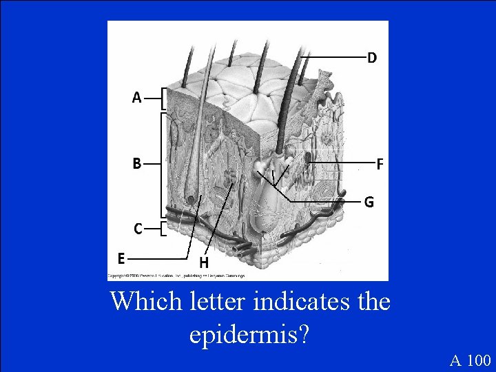 Which letter indicates the epidermis? A 100 
