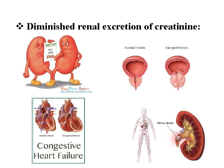 v Diminished renal excretion of creatinine: 