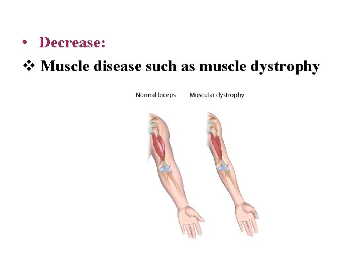  • Decrease: v Muscle disease such as muscle dystrophy 