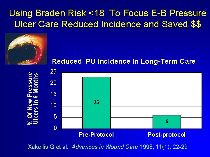 Using Braden Risk <18 To Focus E-B Pressure Ulcer Care Reduced Incidence and Saved