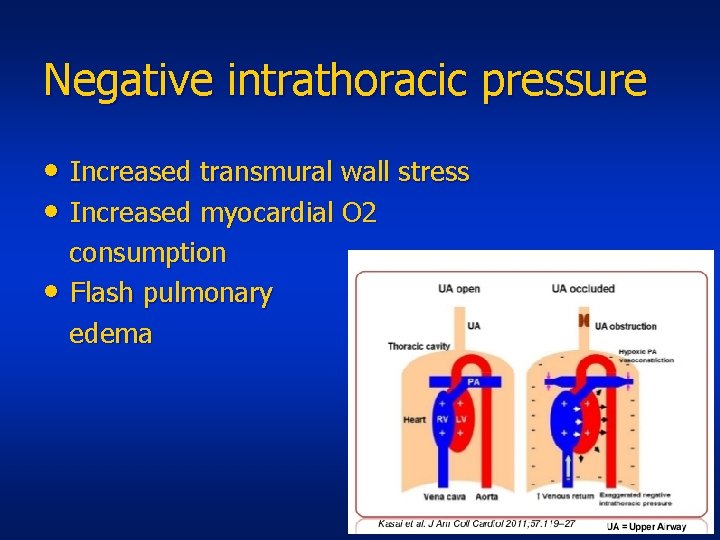 Negative intrathoracic pressure • Increased transmural wall stress • Increased myocardial O 2 •