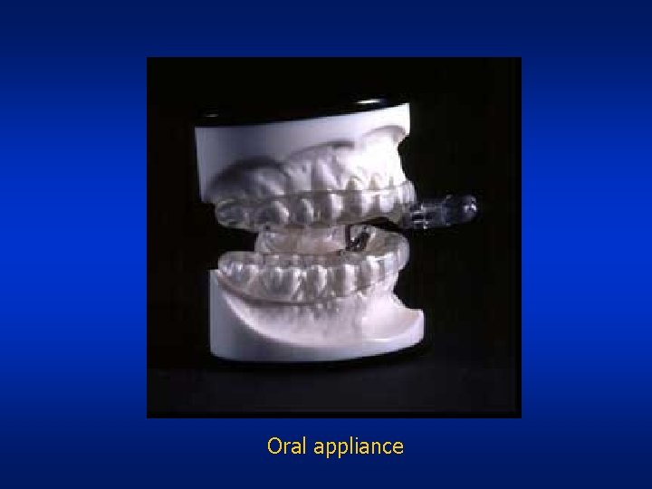 Oral appliance 