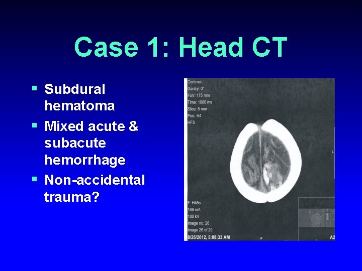 Case 1: Head CT § Subdural hematoma § Mixed acute & subacute hemorrhage §