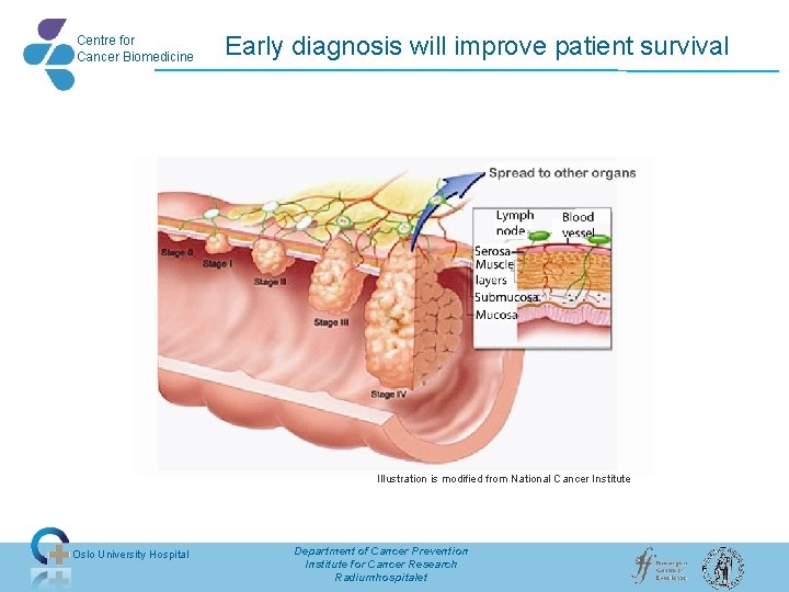 Centre for Cancer Biomedicine Early diagnosis will improve patient survival Illustration is modified from Centre for Cancer Biomedicine Early diagnosis will improve patient survival Illustration is modified from