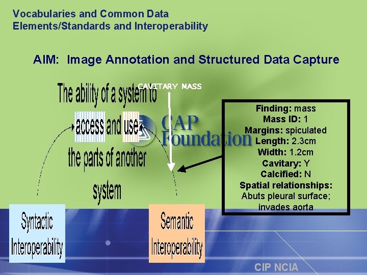 Vocabularies and Common Data Elements/Standards and Interoperability AIM: Image Annotation and Structured Data Capture