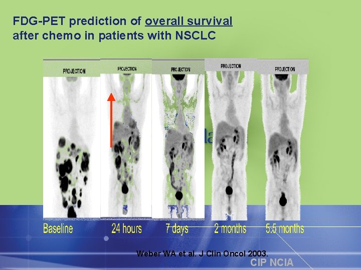 FDG-PET prediction of overall survival after chemo in patients with NSCLC Weber WA et