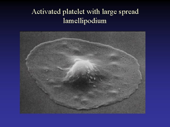 Activated platelet with large spread lamellipodium  Activated platelet with large spread lamellipodium