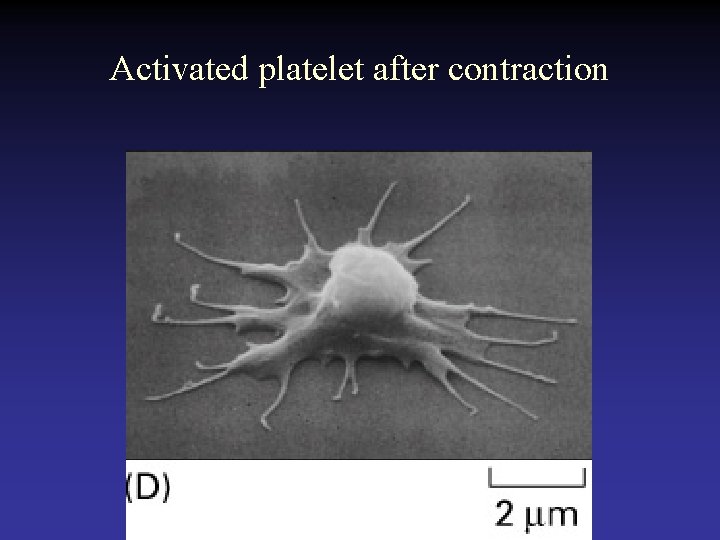 Activated platelet after contraction  Activated platelet after contraction