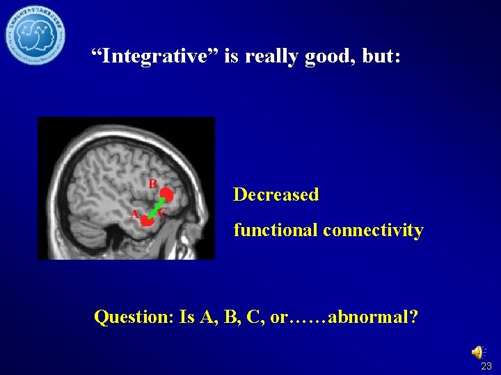 “Integrative” is really good, but: Decreased functional connectivity Question: Is A, B, C, or……abnormal?