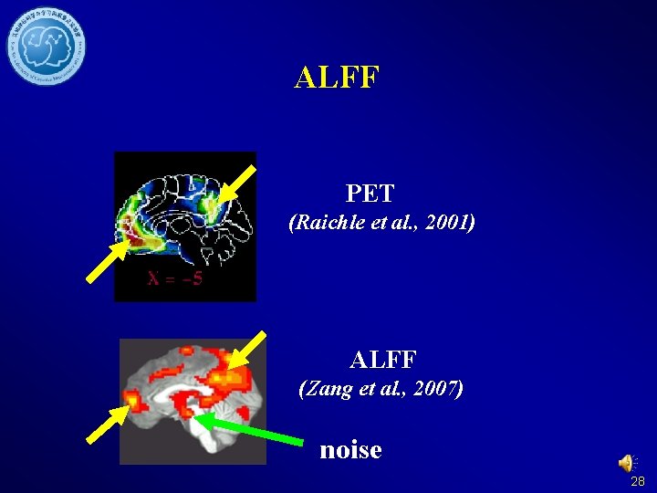 ALFF PET (Raichle et al. , 2001) ALFF (Zang et al. , 2007) noise