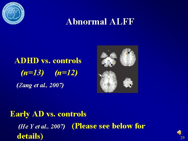 Abnormal ALFF ADHD vs. controls (n=13) (n=12) (Zang et al. , 2007) Early AD