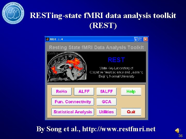 RESTing-state f. MRI data analysis toolkit (REST) By Song et al. , http: //www.