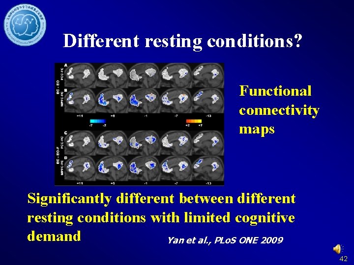 Different resting conditions? Functional connectivity maps Significantly different between different resting conditions with limited