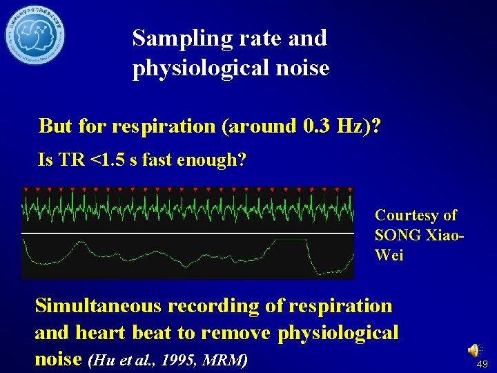 Sampling rate and physiological noise But for respiration (around 0. 3 Hz)? Is TR