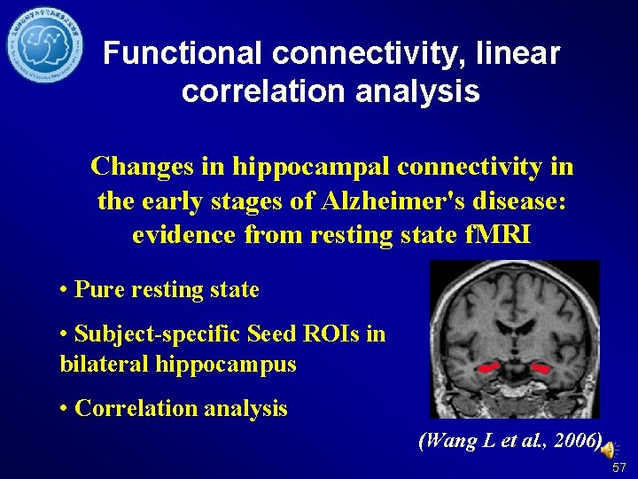 Functional connectivity, linear correlation analysis Changes in hippocampal connectivity in the early stages of