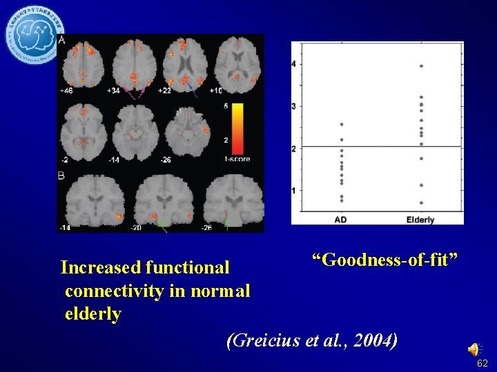 “Goodness-of-fit” Increased functional connectivity in normal elderly (Greicius et al. , 2004) 62 