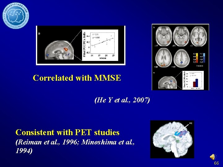 Correlated with MMSE (He Y et al. , 2007) Consistent with PET studies (Reiman