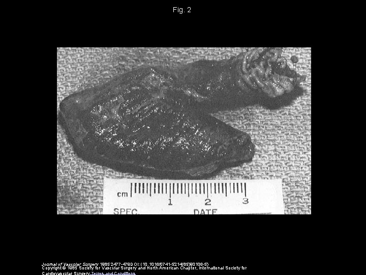 Fig. 2 Journal of Vascular Surgery 1985 2477 -479 DOI: (10. 1016/0741 -5214(85)90106 -5)