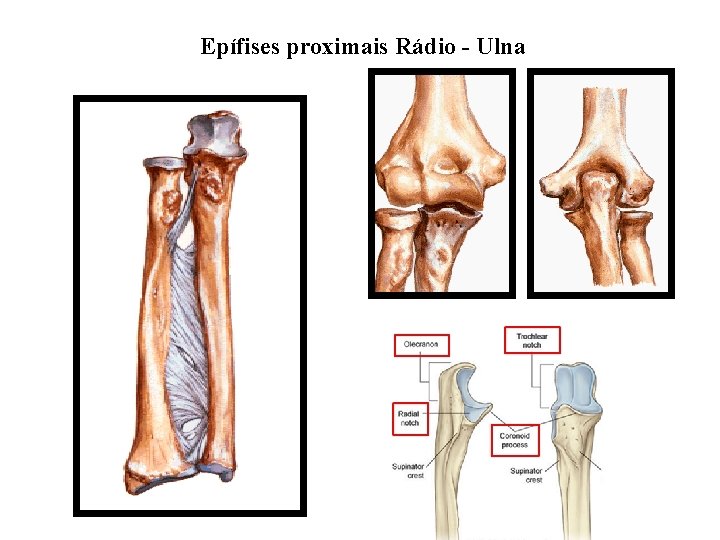 Epífises proximais Rádio - Ulna 