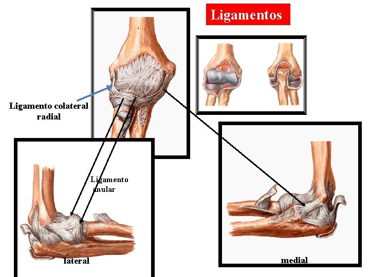 Ligamentos Ligamento colateral radial Ligamento anular lateral medial 