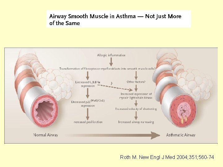 Roth M. New Engl J Med 2004; 351; 560 -74 