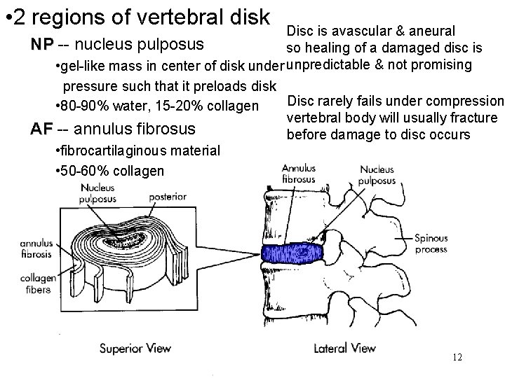  • 2 regions of vertebral disk Disc is avascular & aneural NP --