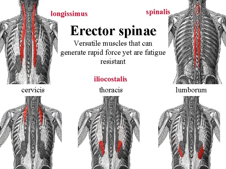 spinalis longissimus Erector spinae Versatile muscles that can generate rapid force yet are fatigue spinalis longissimus Erector spinae Versatile muscles that can generate rapid force yet are fatigue